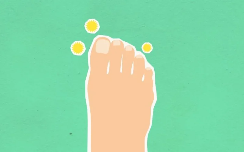 Top view of decorative cardboard illustration representing foot and microbes causing fungal disease on green background