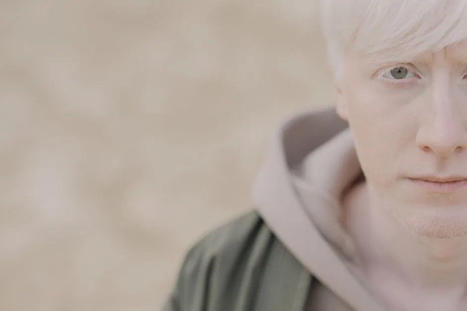 Close-up portrait of a young albino man looking at the camera outdoors with a serene expression.