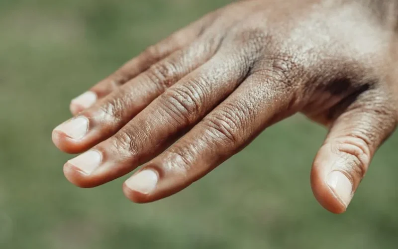 Detailed close-up of a hand showing natural skin texture and nails.